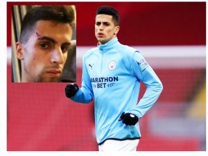 Pemain Bintang  City Dirampok, Perhiasan Ludes